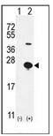 Epithelial Mitogen antibody, AP51442PU-N, Origene, Western Blot image 