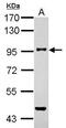 Transforming Growth Factor Beta Receptor 3 antibody, PA5-21994, Invitrogen Antibodies, Western Blot image 