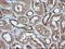 Mitogen-Activated Protein Kinase Kinase 1 antibody, LS-C174648, Lifespan Biosciences, Immunohistochemistry paraffin image 