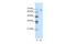 Gamma-Aminobutyric Acid Type A Receptor Theta Subunit antibody, PA5-41049, Invitrogen Antibodies, Western Blot image 