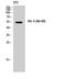 Transforming Growth Factor Beta 1 Induced Transcript 1 antibody, A04630, Boster Biological Technology, Western Blot image 