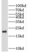 Molybdopterin synthase catalytic subunit antibody, FNab05264, FineTest, Western Blot image 