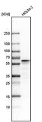Lymphocyte Specific Protein 1 antibody, NBP1-86852, Novus Biologicals, Western Blot image 