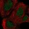 Retinoic Acid Induced 14 antibody, NBP1-94076, Novus Biologicals, Immunocytochemistry image 
