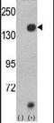 Lysine Demethylase 4A antibody, PA5-11181, Invitrogen Antibodies, Western Blot image 