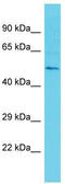 ETS translocation variant 3 antibody, TA342304, Origene, Western Blot image 