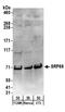 Signal Recognition Particle 68 antibody, A303-955A, Bethyl Labs, Western Blot image 