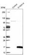 S100 Calcium Binding Protein A14 antibody, NBP1-90000, Novus Biologicals, Western Blot image 