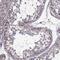 CDC42 Binding Protein Kinase Alpha antibody, NBP2-55964, Novus Biologicals, Immunohistochemistry paraffin image 