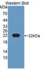 Cancer/Testis Antigen 1B antibody, LS-C373662, Lifespan Biosciences, Western Blot image 