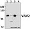 Vav Guanine Nucleotide Exchange Factor 2 antibody, A03014, Boster Biological Technology, Western Blot image 