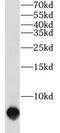 Sarcolipin antibody, FNab07987, FineTest, Western Blot image 