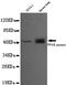 Peroxisome Proliferator Activated Receptor Gamma antibody, MBS475129, MyBioSource, Western Blot image 