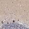 Dapper homolog 1 antibody, PA5-51796, Invitrogen Antibodies, Immunohistochemistry frozen image 