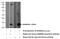 Phospholipase A And Acyltransferase 4 antibody, 12065-1-AP, Proteintech Group, Western Blot image 