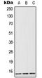 Fatty Acid Binding Protein 1 antibody, LS-C352186, Lifespan Biosciences, Western Blot image 