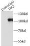 Hexokinase 2 antibody, FNab03848, FineTest, Immunoprecipitation image 