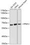Protein Phosphatase, Mg2+/Mn2+ Dependent 1J antibody, 14-657, ProSci, Western Blot image 