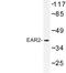 Glutamyl-TRNA Synthetase 2, Mitochondrial antibody, LS-C176728, Lifespan Biosciences, Western Blot image 