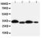 Hydroxysteroid 11-Beta Dehydrogenase 1 antibody, PA1372, Boster Biological Technology, Western Blot image 