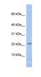 JAM-2 antibody, orb330606, Biorbyt, Western Blot image 