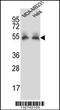 Prolylcarboxypeptidase antibody, 57-023, ProSci, Western Blot image 