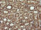 TRNA Methyltransferase 2 Homolog A antibody, M13996, Boster Biological Technology, Immunohistochemistry paraffin image 