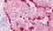 Insulin Receptor antibody, PA5-32877, Invitrogen Antibodies, Immunohistochemistry frozen image 