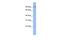 Transmembrane Protein 63B antibody, PA5-41883, Invitrogen Antibodies, Western Blot image 