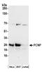 PEST Proteolytic Signal Containing Nuclear Protein antibody, A304-668A, Bethyl Labs, Western Blot image 