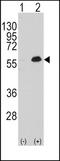 Myocyte Enhancer Factor 2C antibody, TA302223, Origene, Western Blot image 
