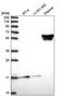 Zinc Finger Protein 317 antibody, PA5-65522, Invitrogen Antibodies, Western Blot image 