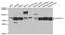Histone-lysine N-methyltransferase NSD3 antibody, TA332777, Origene, Western Blot image 