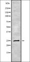 Lysophospholipase 2 antibody, orb337956, Biorbyt, Western Blot image 