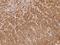 p140Cap antibody, 205689-T10, Sino Biological, Immunohistochemistry paraffin image 