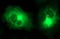 Matrix Metallopeptidase 13 antibody, LS-C797734, Lifespan Biosciences, Immunofluorescence image 