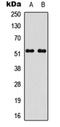STEAP4 Metalloreductase antibody, orb315717, Biorbyt, Western Blot image 