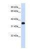 Matrix AAA Peptidase Interacting Protein 1 antibody, NBP1-57840, Novus Biologicals, Western Blot image 