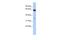 TM40L antibody, A14446, Boster Biological Technology, Western Blot image 