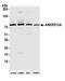 Ankyrin Repeat Domain 13A antibody, A305-868A-M, Bethyl Labs, Western Blot image 