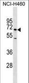 Selectin E antibody, LS-C158937, Lifespan Biosciences, Western Blot image 