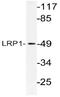 LDL Receptor Related Protein 1 antibody, AP21130PU-N, Origene, Western Blot image 
