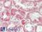 S36A2 antibody, LS-B13091, Lifespan Biosciences, Immunohistochemistry paraffin image 