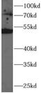 Hyaluronan Synthase 3 antibody, FNab10036, FineTest, Western Blot image 