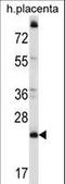 Coiled-Coil Domain Containing 117 antibody, LS-C168391, Lifespan Biosciences, Western Blot image 