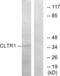 Cysteinyl Leukotriene Receptor 1 antibody, LS-B9269, Lifespan Biosciences, Western Blot image 