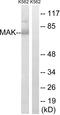 Male Germ Cell Associated Kinase antibody, LS-C199210, Lifespan Biosciences, Western Blot image 