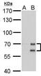 Lamin A/C antibody, GTX629404, GeneTex, Western Blot image 