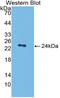 Plasminogen Activator, Tissue Type antibody, LS-C314535, Lifespan Biosciences, Western Blot image 