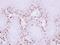 Melanoma-associated antigen 11 antibody, NBP1-31210, Novus Biologicals, Immunohistochemistry paraffin image 